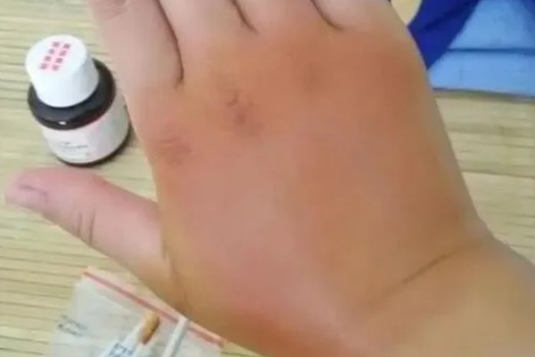 马蜂在窗户角筑巢如何处理,可穿戴防蛰护具捣毁蜂巢