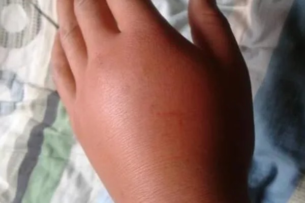 马蜂在窗户角筑巢如何处理,可穿戴防蛰护具捣毁蜂巢