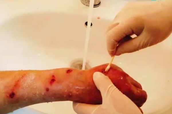 马蜂在窗户角筑巢如何处理,可穿戴防蛰护具捣毁蜂巢