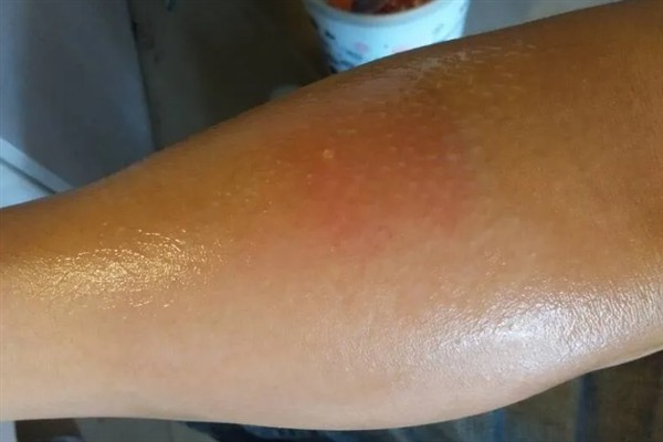 中国大虎头蜂的简介，学名叫做金环胡蜂
