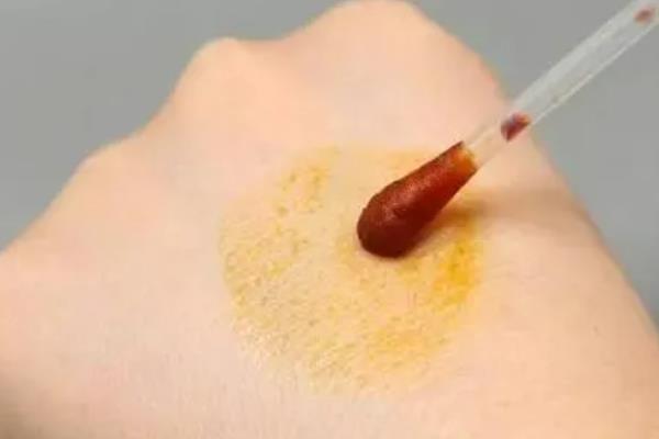 蜜蜂蛰了如何处理，第一步就是拔出刺