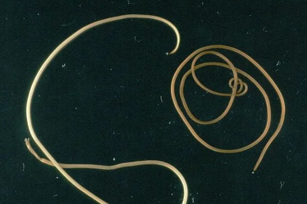 兔肝毛细线虫感染症状,严重时消化系统会紊乱