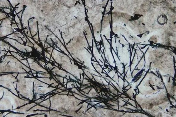 双孢菇种植出现问题怎么处理，必须立刻停止喷水并加强通风