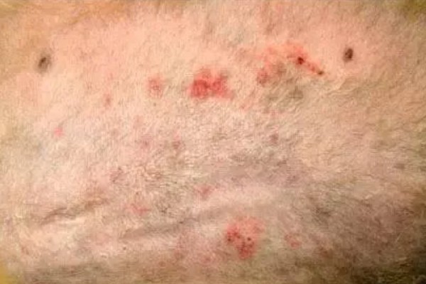 狗狗为何患上湿疹,过敏、外界刺激等因素都会引起
